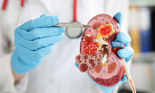 Causes of Kidney Stone