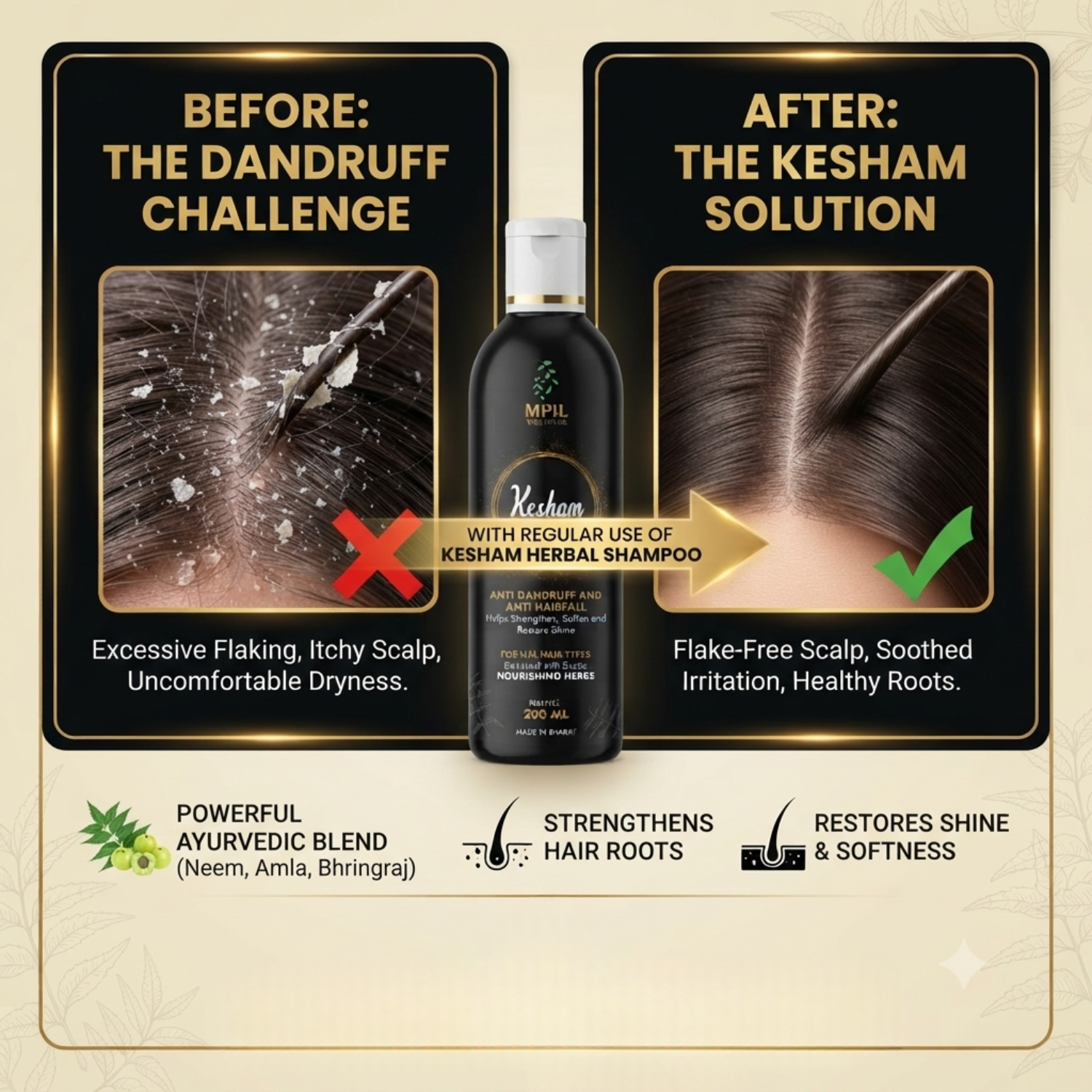 Kesham Herbal Anti dandruff Shampoo 200ml (Pack of 2)