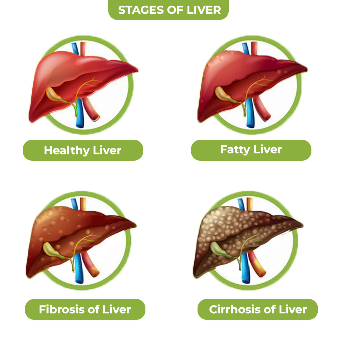 LIVAM DS KIT  Liver Care